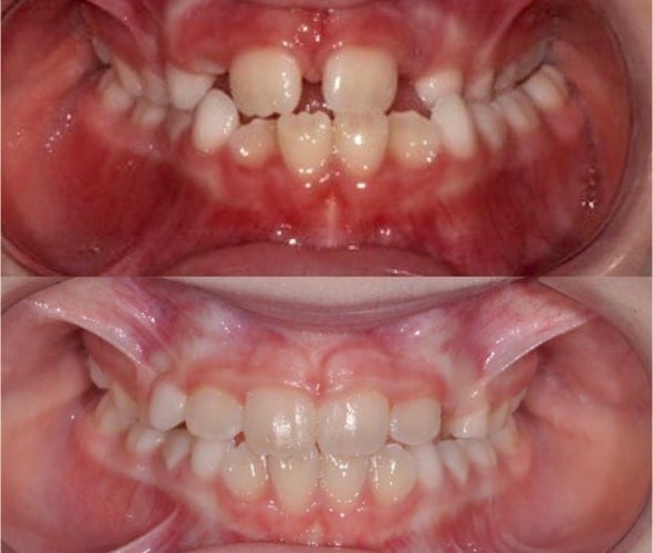 before and after photo